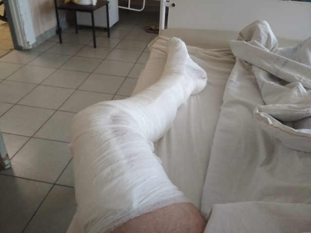 После оперции.jpg После оперции.jpg